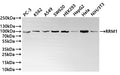 Western Blot
Positive WB detected in: PC-3 whole cell lysate(30µg) , K562 whole cell lysate(30µg) , A549 whole cell lysate(30µg) , SW620 whole cell lysate(30µg) , HEK293 whole cell lysate(30µg) , HepG2 whole cell lysate(30µg) , Hela whole cell lysate(30µg) , NIH/3T3 whole cell lysate(30µg) 
All lanes: RRM1 antibody at 1:1000
Secondary
Goat polyclonal to rabbit IgG at 1/40000 dilution
Predicted band size: 90 kDa
Observed band size: 90 kDa
Exposure time：1min