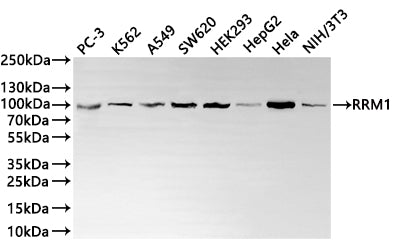Western Blot
Positive WB detected in: PC-3 whole cell lysate(30µg) , K562 whole cell lysate(30µg) , A549 whole cell lysate(30µg) , SW620 whole cell lysate(30µg) , HEK293 whole cell lysate(30µg) , HepG2 whole cell lysate(30µg) , Hela whole cell lysate(30µg) , NIH/3T3 whole cell lysate(30µg) 
All lanes: RRM1 antibody at 1:1000
Secondary
Goat polyclonal to rabbit IgG at 1/40000 dilution
Predicted band size: 90 kDa
Observed band size: 90 kDa
Exposure time：1min