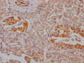 IHC image of CSB-RA787345A0HU diluted at 1:100 and staining in paraffin-embedded human pancreatic tissue performed on a Leica BondTM system. After dewaxing and hydration, antigen retrieval was mediated by high pressure in a citrate buffer (pH 6.0) . Section was blocked with 10% normal goat serum 30min at RT. Then primary antibody (1% BSA) was incubated at 4℃ overnight. The primary is detected by a Goat anti-rabbit IgG polymer labeled by HRP and visualized using 0.05% DAB.