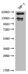 Western Blot
Positive WB detected in: THP-1 whole cell lysate
All lanes: ITGAL antibody at 1:2000
Secondary
Goat polyclonal to rabbit IgG at 1/50000 dilution
Predicted band size: 129, 135, 120 kDa
Observed band size: 130 kDa