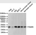 Western Blot
Positive WB detected in: Hela whole cell lysate(30µg), PC-3 whole cell lysate(30µg), Raji whole cell lysate(30µg), MCF-7 whole cell lysate(30µg), Mouse brain tissue lysate(30µg), Rat brain tissue lysate(30µg)
All lanes: Rab8A antibody at 1:1000
Secondary
Goat polyclonal to rabbit IgG at 1/40000 dilution
Predicted band size: 24 kDa
Observed band size: 24 kDa
Exposure time：2min