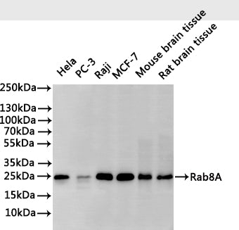 Western Blot
Positive WB detected in: Hela whole cell lysate(30µg), PC-3 whole cell lysate(30µg), Raji whole cell lysate(30µg), MCF-7 whole cell lysate(30µg), Mouse brain tissue lysate(30µg), Rat brain tissue lysate(30µg)
All lanes: Rab8A antibody at 1:1000
Secondary
Goat polyclonal to rabbit IgG at 1/40000 dilution
Predicted band size: 24 kDa
Observed band size: 24 kDa
Exposure time：2min