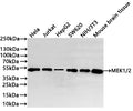 Western Blot
Positive WB detected in: Hela whole cell lysate(30µg) , Jurkat whole cell lysate(30µg) , HepG2 whole cell lysate(30µg) , SW620 whole cell lysate(30µg) , NIH/3T3 whole cell lysate(30µg) , Mouse brain tissue lysate(30µg) 
All lanes: MEK1/2 antibody at 1:1000
Secondary
Goat polyclonal to rabbit IgG at 1/40000 dilution
Predicted band size: 43, , 44 kDa
Observed band size: 50 kDa
Exposure time：40s