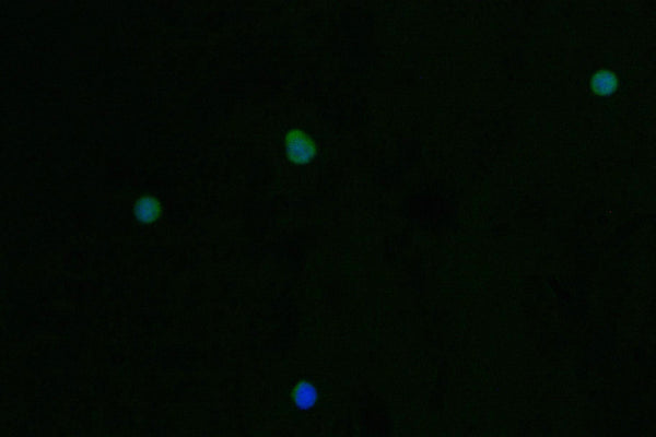 Immunofluorescence staining of Jurkat cell with CSB-RA789332A0HU at 1:50, counter-stained with DAPI. The cells were fixed in 4% formaldehyde and blocked in 10% normal Goat Serum. The cells were then incubated with the antibody overnight at 4°C. The secondary antibody was Alexa Fluor 562-congugated AffiniPure Goat Anti-Rabbit IgG(H+L) .