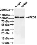 Western Blot
Positive WB detected in: A-431 whole cell lysate(30µg) , Jurkat whole cell lysate(30µg) 
All lanes: PKD2 antibody at 1:1000
Secondary
Goat polyclonal to rabbit IgG at 1/40000 dilution
Predicted band size: 97 kDa kDa
Observed band size: 105 kDa kDa
Exposure time：2min