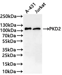 Western Blot
Positive WB detected in: A-431 whole cell lysate(30µg) , Jurkat whole cell lysate(30µg) 
All lanes: PKD2 antibody at 1:1000
Secondary
Goat polyclonal to rabbit IgG at 1/40000 dilution
Predicted band size: 97 kDa kDa
Observed band size: 105 kDa kDa
Exposure time：2min