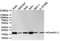 Western Blot
Positive WB detected in:  A549 whole cell lysate(30µg) , HEK293T whole cell lysate(30µg) , Hela whole cell lysate(30µg) , A431 whole cell lysate(30µg) , MCF-7 whole cell lysate(30µg) , U-251MG whole cell lysate(30µg) 
All lanes: Caveolin 2 antibody at 1:1000
Secondary
Goat polyclonal to rabbit IgG at 1/40000 dilution
Predicted band size: 18 kDa
Observed band size: 18 kDa
Exposure time：40s