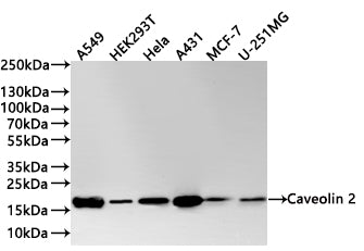 Western Blot
Positive WB detected in:  A549 whole cell lysate(30µg) , HEK293T whole cell lysate(30µg) , Hela whole cell lysate(30µg) , A431 whole cell lysate(30µg) , MCF-7 whole cell lysate(30µg) , U-251MG whole cell lysate(30µg) 
All lanes: Caveolin 2 antibody at 1:1000
Secondary
Goat polyclonal to rabbit IgG at 1/40000 dilution
Predicted band size: 18 kDa
Observed band size: 18 kDa
Exposure time：40s