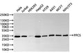 Western Blot
Positive WB detected in: Hela whole cell lysate(30µg), Jurkat whole cell lysate(30µg), HEK293 whole cell lysate(30µg), HepG2 whole cell lysate(30µg), HT-29 whole cell lysate(30µg), A431 whole cell lysate(30µg), MCF-7 whole cell lysate(30µg), NIH/3T3 whole cell lysate(30µg)
All lanes: PPCS antibody at 1:1000
Secondary
Goat polyclonal to rabbit IgG at 1/40000 dilution
Predicted band size: 34 kDa
Observed band size: 34 kDa
Exposure time：10s