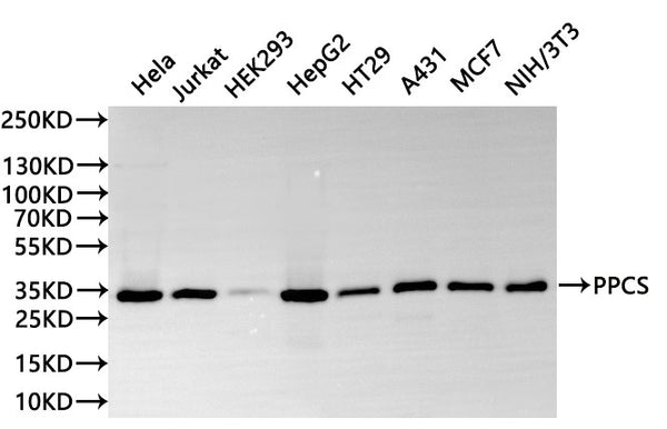 Western Blot
Positive WB detected in: Hela whole cell lysate(30µg), Jurkat whole cell lysate(30µg), HEK293 whole cell lysate(30µg), HepG2 whole cell lysate(30µg), HT-29 whole cell lysate(30µg), A431 whole cell lysate(30µg), MCF-7 whole cell lysate(30µg), NIH/3T3 whole cell lysate(30µg)
All lanes: PPCS antibody at 1:1000
Secondary
Goat polyclonal to rabbit IgG at 1/40000 dilution
Predicted band size: 34 kDa
Observed band size: 34 kDa
Exposure time：10s