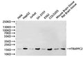 Western Blot
Positive WB detected in: Hela whole cell lysate(30µg), HEK293 whole cell lysate(30µg), Jurkat whole cell lysate(30µg), SH-SY5Y whole cell lysate(30µg), K562 whole cell lysate(30µg), COLO-205 whole cell lysate(30µg), Mouse brain tissue lysate(30µg), Rat brain tissue lysate(30µg)
All lanes:TRAPPC2 antibody at 1:1000
Secondary
Goat polyclonal to rabbit IgG at 1/40000 dilution
Predicted band size: 16 kDa
Observed band size: 14 kDa
Exposure time：2min