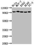 Western Blot
Positive WB detected in: Hela whole cell lysate, MCF-7 whole cell lysate, K562 whole cell lysate, HL60 whole cell lysate, PC-3 whole cell lysate
All lanes: TOP1 antibody at 1:2000
Secondary
Goat polyclonal to rabbit IgG at 1/50000 dilution
Predicted band size: 91 kDa
Observed band size: 91 kDa