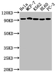 Western Blot
Positive WB detected in: Hela whole cell lysate, MCF-7 whole cell lysate, K562 whole cell lysate, HL60 whole cell lysate, PC-3 whole cell lysate
All lanes: TOP1 antibody at 1:2000
Secondary
Goat polyclonal to rabbit IgG at 1/50000 dilution
Predicted band size: 91 kDa
Observed band size: 91 kDa