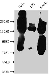 Western Blot
Positive WB detected in: Hela whole cell lysate, L02 whole cell lysate, HepG2 whole cell lysate
All lanes: EGFR antibody at 1:1000
Secondary
Goat polyclonal to rabbit IgG at 1/50000 dilution
Predicted band size: 135, 45, 78, 70 kDa
Observed band size: 150 kDa