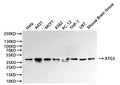 Western Blot
Positive WB detected in: Hela whole cell lysate(30µg), A431 whole cell lysate(30µg), MCF-7 whole cell lysate(30µg), K562 whole cell lysate(30µg), PC-12 whole cell lysate(30µg), THP-1 whole cell lysate(30µg), U-87MG whole cell lysate(30µg), Mouse brain tissue lysate(30µg)
All lanes: ATG3 antibody at 1:1000
Secondary
Goat polyclonal to rabbit IgG at 1/40000 dilution
Predicted band size: 36 kDa
Observed band size: 40 kDa
Exposure time：2min