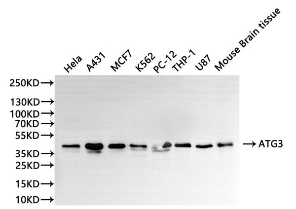 Western Blot
Positive WB detected in: Hela whole cell lysate(30µg), A431 whole cell lysate(30µg), MCF-7 whole cell lysate(30µg), K562 whole cell lysate(30µg), PC-12 whole cell lysate(30µg), THP-1 whole cell lysate(30µg), U-87MG whole cell lysate(30µg), Mouse brain tissue lysate(30µg)
All lanes: ATG3 antibody at 1:1000
Secondary
Goat polyclonal to rabbit IgG at 1/40000 dilution
Predicted band size: 36 kDa
Observed band size: 40 kDa
Exposure time：2min