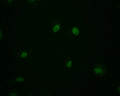 Immunofluorescence staining of MCF-7 cell with CSB-RA794480A0HU at 1:50, counter-stained with DAPI. The cells were fixed in 4% formaldehyde and blocked in 10% normal Goat Serum. The cells were then incubated with the antibody overnight at 4°C. The secondary antibody was Alexa Fluor 498-congugated AffiniPure Goat Anti-Rabbit IgG(H+L) .