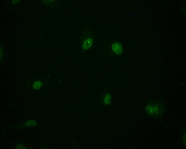 Immunofluorescence staining of MCF-7 cell with CSB-RA794480A0HU at 1:50, counter-stained with DAPI. The cells were fixed in 4% formaldehyde and blocked in 10% normal Goat Serum. The cells were then incubated with the antibody overnight at 4°C. The secondary antibody was Alexa Fluor 498-congugated AffiniPure Goat Anti-Rabbit IgG(H+L) .