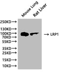 Western Blot
Positive WB detected in: Mouse lung tissue lysate, Rat liver tissue lysate
All lanes: LRP1 antibody at 1:1000
Secondary
Goat polyclonal to rabbit IgG at 1/50000 dilution
Predicted band size: 505 kDa
Observed band size: 100 kDa