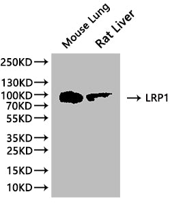 Western Blot
Positive WB detected in: Mouse lung tissue lysate, Rat liver tissue lysate
All lanes: LRP1 antibody at 1:1000
Secondary
Goat polyclonal to rabbit IgG at 1/50000 dilution
Predicted band size: 505 kDa
Observed band size: 100 kDa