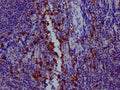 IHC image of CSB-RA794900A0HU diluted at 1:100 and staining in paraffin-embedded human tonsil tissue performed on a Leica BondTM system. After dewaxing and hydration, antigen retrieval was mediated by high pressure in a citrate buffer (pH 6.0) . Section was blocked with 10% normal goat serum 30min at RT. Then primary antibody (1% BSA) was incubated at 4℃ overnight. The primary is detected by a Goat anti-rabbit IgG polymer labeled by HRP and visualized using 0.05% DAB.