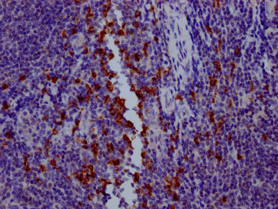 IHC image of CSB-RA794900A0HU diluted at 1:100 and staining in paraffin-embedded human tonsil tissue performed on a Leica BondTM system. After dewaxing and hydration, antigen retrieval was mediated by high pressure in a citrate buffer (pH 6.0) . Section was blocked with 10% normal goat serum 30min at RT. Then primary antibody (1% BSA) was incubated at 4℃ overnight. The primary is detected by a Goat anti-rabbit IgG polymer labeled by HRP and visualized using 0.05% DAB.