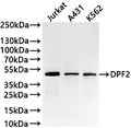 Western Blot
Positive WB detected in: Jurkat whole cell lysate(30µg) , A431 whole cell lysate(30µg) , K562 whole cell lysate(30µg) 
All lanes: DPF2 antibody at 1:1000
Secondary
Goat polyclonal to rabbit IgG at 1/40000 dilution
Predicted band size: 44 kDa
Observed band size: 44 kDa
Exposure time：1min