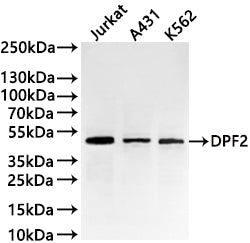 Western Blot
Positive WB detected in: Jurkat whole cell lysate(30µg) , A431 whole cell lysate(30µg) , K562 whole cell lysate(30µg) 
All lanes: DPF2 antibody at 1:1000
Secondary
Goat polyclonal to rabbit IgG at 1/40000 dilution
Predicted band size: 44 kDa
Observed band size: 44 kDa
Exposure time：1min