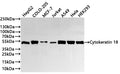 Western Blot
Positive WB detected in: HepG2 whole cell lysate(30µg) , COLO-205 whole cell lysate(30µg) , MCF-7 whole cell lysate(30µg) , Jurkat whole cell lysate(30µg) , A549 whole cell lysate(30µg) , Hela whole cell lysate(30µg) , HEK293 whole cell lysate(30µg) 
All lanes: Cytokeratin 18 antibody at 1:1000
Secondary
Goat polyclonal to rabbit IgG at 1/40000 dilution
Predicted band size: 48 kDa
Observed band size: 48 kDa
Exposure time：40s