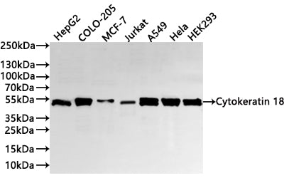 Western Blot
Positive WB detected in: HepG2 whole cell lysate(30µg) , COLO-205 whole cell lysate(30µg) , MCF-7 whole cell lysate(30µg) , Jurkat whole cell lysate(30µg) , A549 whole cell lysate(30µg) , Hela whole cell lysate(30µg) , HEK293 whole cell lysate(30µg) 
All lanes: Cytokeratin 18 antibody at 1:1000
Secondary
Goat polyclonal to rabbit IgG at 1/40000 dilution
Predicted band size: 48 kDa
Observed band size: 48 kDa
Exposure time：40s