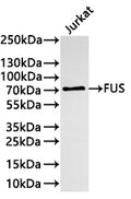 Western Blot
Positive WB detected in:Jurkat whole cell lysate(30µg) 
All lanes: FUS antibody at 1:1000
Secondary
Goat polyclonal to rabbit IgG at 1/40000 dilution
Predicted band size: 53 kDa
Observed band size: 70 kDa
Exposure time：2min