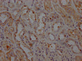 IHC image of CSB-RA797150A0HU diluted at 1:100 and staining in paraffin-embedded human kidney tissue performed on a Leica BondTM system. After dewaxing and hydration, antigen retrieval was mediated by high pressure in a citrate buffer (pH 6.0) . Section was blocked with 10% normal goat serum 30min at RT. Then primary antibody (1% BSA) was incubated at 4℃ overnight. The primary is detected by a Goat anti-rabbit IgG polymer labeled by HRP and visualized using 0.05% DAB.