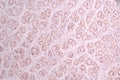 IHC image of CSB-RA797360A0HU diluted at 1:100 and staining in paraffin-embedded human stomach tissue performed on a Leica BondTM system. After dewaxing and hydration, antigen retrieval was mediated by high pressure in a citrate buffer (pH 6.0) . Section was blocked with 10% normal goat serum 30min at RT. Then primary antibody (1% BSA) was incubated at 4°C overnight. The primary is detected by a Goat anti-rabbit polymer IgG labeled by HRP and visualized using 0.05% DAB.