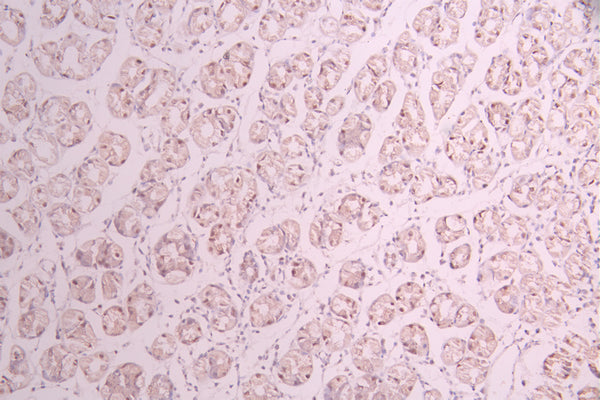 IHC image of CSB-RA797360A0HU diluted at 1:100 and staining in paraffin-embedded human stomach tissue performed on a Leica BondTM system. After dewaxing and hydration, antigen retrieval was mediated by high pressure in a citrate buffer (pH 6.0) . Section was blocked with 10% normal goat serum 30min at RT. Then primary antibody (1% BSA) was incubated at 4°C overnight. The primary is detected by a Goat anti-rabbit polymer IgG labeled by HRP and visualized using 0.05% DAB.