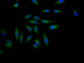 Immunofluorescence staining of Hela Cells with CSB-RA797631A0HU at 1:50, counter-stained with DAPI. The cells were fixed in 4% formaldehyde, permeated by 0.2% TritonX-100, and blocked in 10% normal Goat Serum. The cells were then incubated with the antibody overnight at 4℃. Nuclear DNA was labeled in blue with DAPI. The secondary antibody was FITC-conjugated AffiniPure Goat Anti-Rabbit IgG (H+L) .