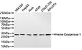 Western Blot
Positive WB detected in: HepG2 whole cell lysate(20µg) ,Hela whole cell lysate(20µg) ,A549 whole cell lysate(20µg) , COLO-205 whole cell lysate(20µg) ,NIH/3T3 whole cell lysate(20µg) 
All lanes: Heme Oxygenase 1 antibody at 1:1000
Secondary
Goat polyclonal to rabbit IgG at 1/40000 dilution
Predicted band size: 33 kDa
Observed band size: 33 kDa
Exposure time：2s