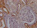 IHC image of CSB-RA799368A0HU diluted at 1:100 and staining in paraffin-embedded human kidney tissue performed on a Leica BondTM system. After dewaxing and hydration, antigen retrieval was mediated by high pressure in a citrate buffer (pH 6.0) . Section was blocked with 10% normal goat serum 30min at RT. Then primary antibody (1% BSA) was incubated at 4℃ overnight. The primary is detected by a Goat anti-rabbit IgG polymer labeled by HRP and visualized using 0.05% DAB.