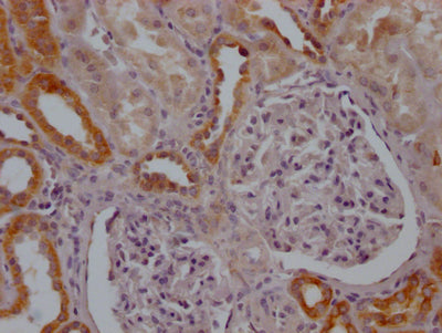 IHC image of CSB-RA799368A0HU diluted at 1:100 and staining in paraffin-embedded human kidney tissue performed on a Leica BondTM system. After dewaxing and hydration, antigen retrieval was mediated by high pressure in a citrate buffer (pH 6.0) . Section was blocked with 10% normal goat serum 30min at RT. Then primary antibody (1% BSA) was incubated at 4℃ overnight. The primary is detected by a Goat anti-rabbit IgG polymer labeled by HRP and visualized using 0.05% DAB.