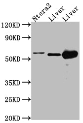 ALDH2 Antibody – Figure 1 of 2