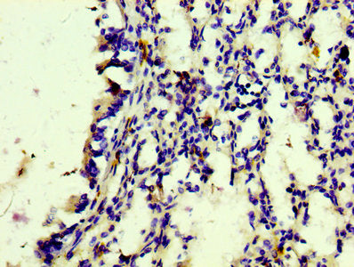 IHC image of CSB-RA801238A0HU diluted at 1:100 and staining in paraffin-embedded human lung tissue performed on a Leica BondTM system. After dewaxing and hydration, antigen retrieval was mediated by high pressure in a citrate buffer (pH 6.0) . Section was blocked with 10% normal goat serum 30min at RT. Then primary antibody (1% BSA) was incubated at 4℃ overnight. The primary is detected by a biotinylated secondary antibody and visualized using an HRP conjugated SP system.