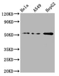 Western Blot
Positive WB detected in: Hela whole cell lysate, A549 whole cell lysate, HepG2 whole cell lysate
All lanes: CD47 antibody at 1:2000
Secondary
Goat polyclonal to rabbit IgG at 1/50000 dilution
Predicted band size: 36, 32, 34 kDa
Observed band size: 55 kDa