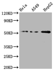 Western Blot
Positive WB detected in: Hela whole cell lysate, A549 whole cell lysate, HepG2 whole cell lysate
All lanes: CD47 antibody at 1:2000
Secondary
Goat polyclonal to rabbit IgG at 1/50000 dilution
Predicted band size: 36, 32, 34 kDa
Observed band size: 55 kDa