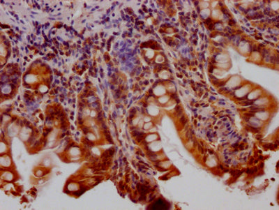 IHC image of CSB-RA802195A0HU diluted at 1:100 and staining in paraffin-embedded human small intestine tissue performed on a Leica BondTM system. After dewaxing and hydration, antigen retrieval was mediated by high pressure in a citrate buffer (pH 6.0) . Section was blocked with 10% normal goat serum 30min at RT. Then primary antibody (1% BSA) was incubated at 4℃ overnight. The primary is detected by a Goat anti-rabbit IgG polymer labeled by HRP and visualized using 0.05% DAB.