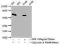 Phospho-PRKAA2 (Thr172) Antibody – Figure 1 of 2