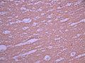 IHC image of CSB-RA805422A0HU diluted at 1:100 and staining in paraffin-embedded human brain tissue performed on a Leica BondTM system. After dewaxing and hydration, antigen retrieval was mediated by high pressure in a citrate buffer (pH 6.0). Section was blocked with 10% normal goat serum 30min at RT. Then primary antibody (1% BSA) was incubated at 4°C overnight. The primary is detected by a Goat anti-rabbit polymer IgG labeled by HRP and visualized using 0.05% DAB.