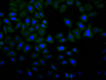 Immunofluorescence staining of Hela cell with CSB-RA821036MA1HU at 1:30 ,counter-stained with DAPI. The cells were fixed in 4% formaldehyde, permeabilized using 0.2% Triton X-100 and blocked in 10% normal Goat Serum. The cells were then incubated with the antibody overnight at 4°C. The secondary antibody was Alexa Fluor 488-congugated AffiniPure Goat Anti-Human IgG(H+L) .