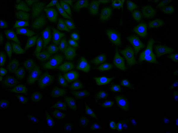 Immunofluorescence staining of Hela cell with CSB-RA821036MA1HU at 1:30 ,counter-stained with DAPI. The cells were fixed in 4% formaldehyde, permeabilized using 0.2% Triton X-100 and blocked in 10% normal Goat Serum. The cells were then incubated with the antibody overnight at 4°C. The secondary antibody was Alexa Fluor 488-congugated AffiniPure Goat Anti-Human IgG(H+L) .