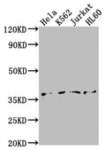 Western Blot
Positive WB detected in: Hela whole cell lysate, K562 whole cell lysate, Jurkat whole cell lysate, HL60 whole cell lysate
All lanes: TBP antibody at 1:2000
Secondary
Goat polyclonal to rabbit IgG at 1/50000 dilution
Predicted band size: 38, 36 kDa
Observed band size: 36 kDa