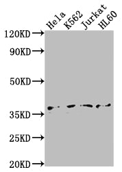 Western Blot
Positive WB detected in: Hela whole cell lysate, K562 whole cell lysate, Jurkat whole cell lysate, HL60 whole cell lysate
All lanes: TBP antibody at 1:2000
Secondary
Goat polyclonal to rabbit IgG at 1/50000 dilution
Predicted band size: 38, 36 kDa
Observed band size: 36 kDa