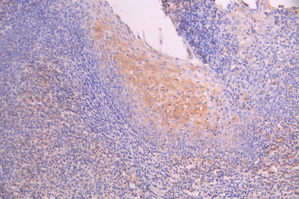 IHC image of CSB-RA822164MA1HU diluted at 1:50 and staining in paraffin-embedded human tonsil tissue performed on a Leica BondTM system. After dewaxing and hydration, antigen retrieval was mediated by high pressure in a citrate buffer (pH 6.0) . Section was blocked with 10% normal goat serum 30min at RT. Then primary antibody (1% BSA) was incubated at 4°C overnight. The primary is detected by a Anti-Human lgG, Fcy Fragment Specific labeled by HRP and visualized using 0.05% DAB.